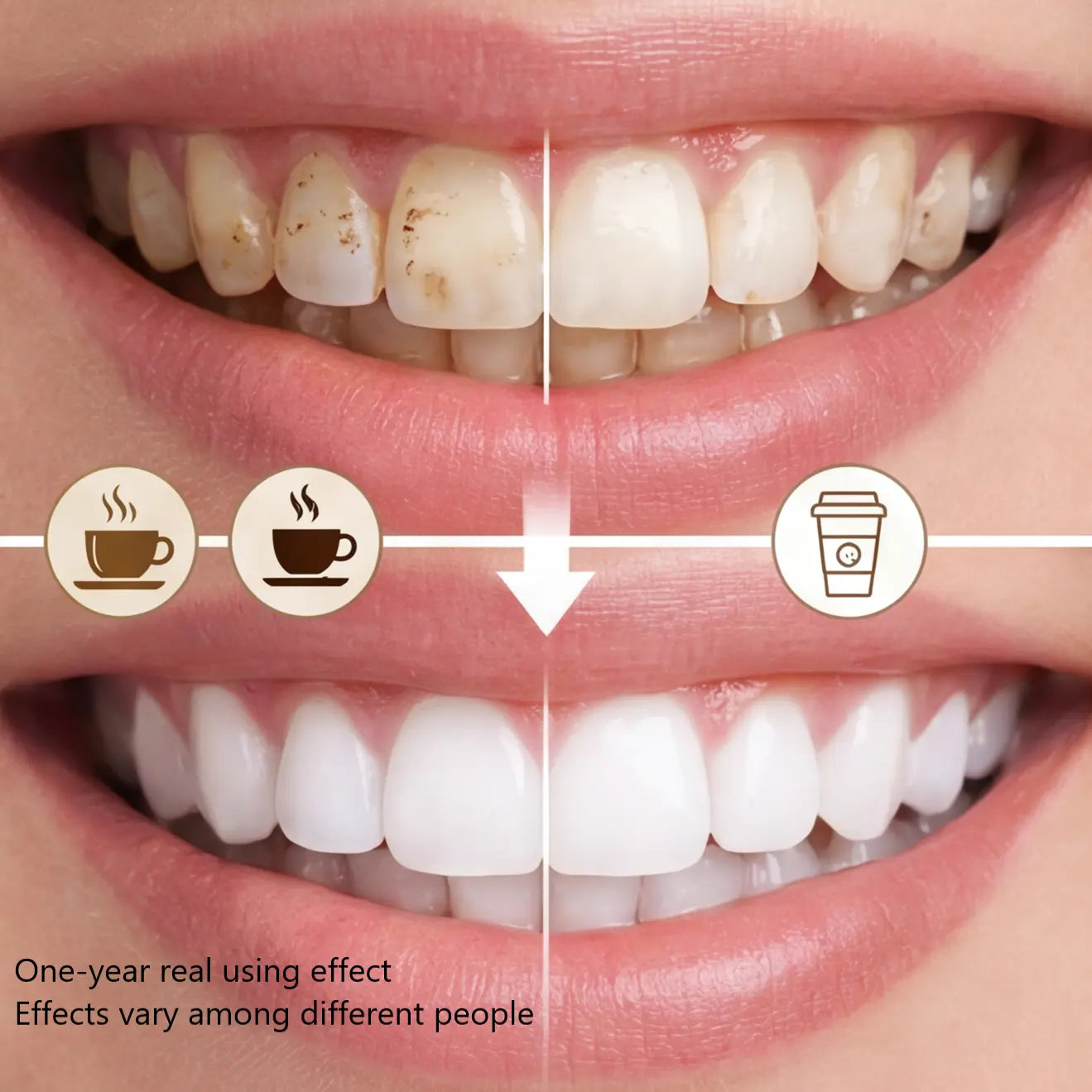 Niacinamide Whitening Toothpaste for Bright White Teeth & Fresh Breath