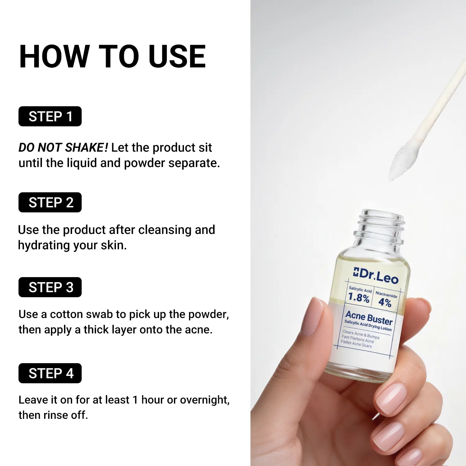 Dr.Leo Drying Lotion | Pimple Treatment & Body Acne Treatment | Visibly Shrinks Pimples in 24 Hours & Helps Fade Acne Marks in 7 Days | With 1.8%25 Encapsulated Salicylic Acid, 4%25 Niacinamide & 10%25 Sulfur (20ml) #mothersdaygift #Summervibe