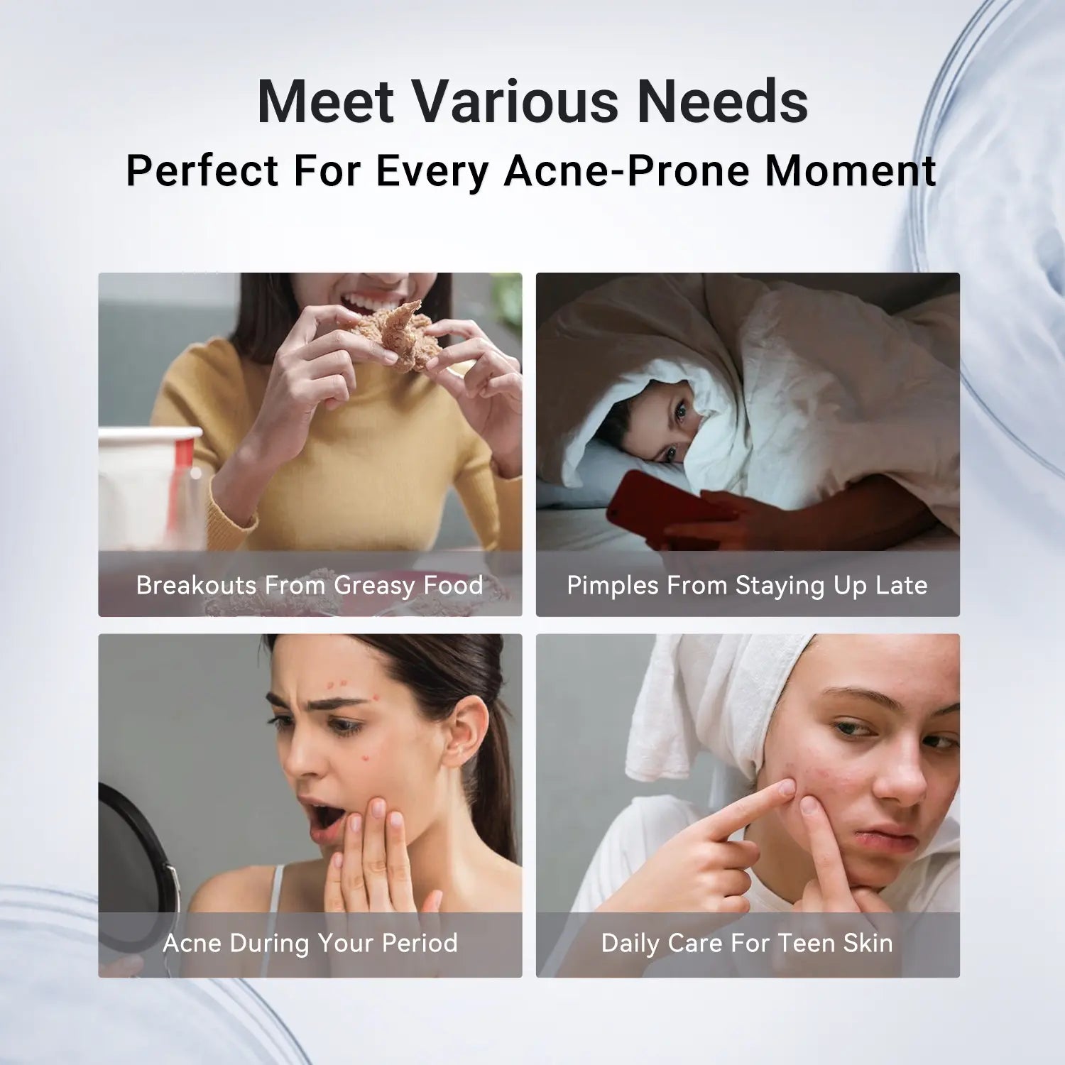 Dr.Leo Drying Lotion | Pimple Treatment & Body Acne Treatment | Visibly Shrinks Pimples in 24 Hours & Helps Fade Acne Marks in 7 Days | With 1.8%25 Encapsulated Salicylic Acid, 4%25 Niacinamide & 10%25 Sulfur (20ml) #mothersdaygift #Summervibe