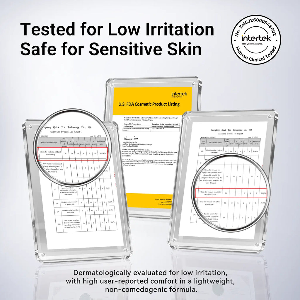 Dr.Leo Drying Lotion | Pimple Treatment & Body Acne Treatment | Visibly Shrinks Pimples in 24 Hours & Helps Fade Acne Marks in 7 Days | With 1.8%25 Encapsulated Salicylic Acid, 4%25 Niacinamide & 10%25 Sulfur (20ml) #mothersdaygift #Summervibe